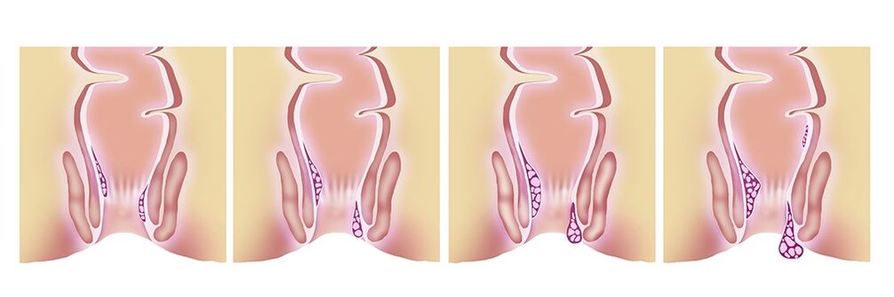 Gelarex efficace in tutte le fasi